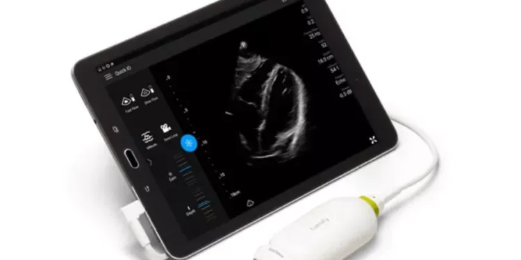 Philips donates 390 Lumify handheld ultrasound devices to the Imbuto Foundation