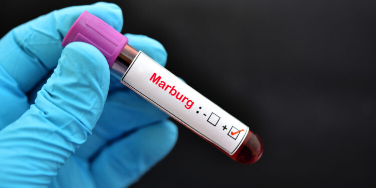Rwanda Pioneers Marburg Virus Research to Unlock Key Insights for Future Vaccines